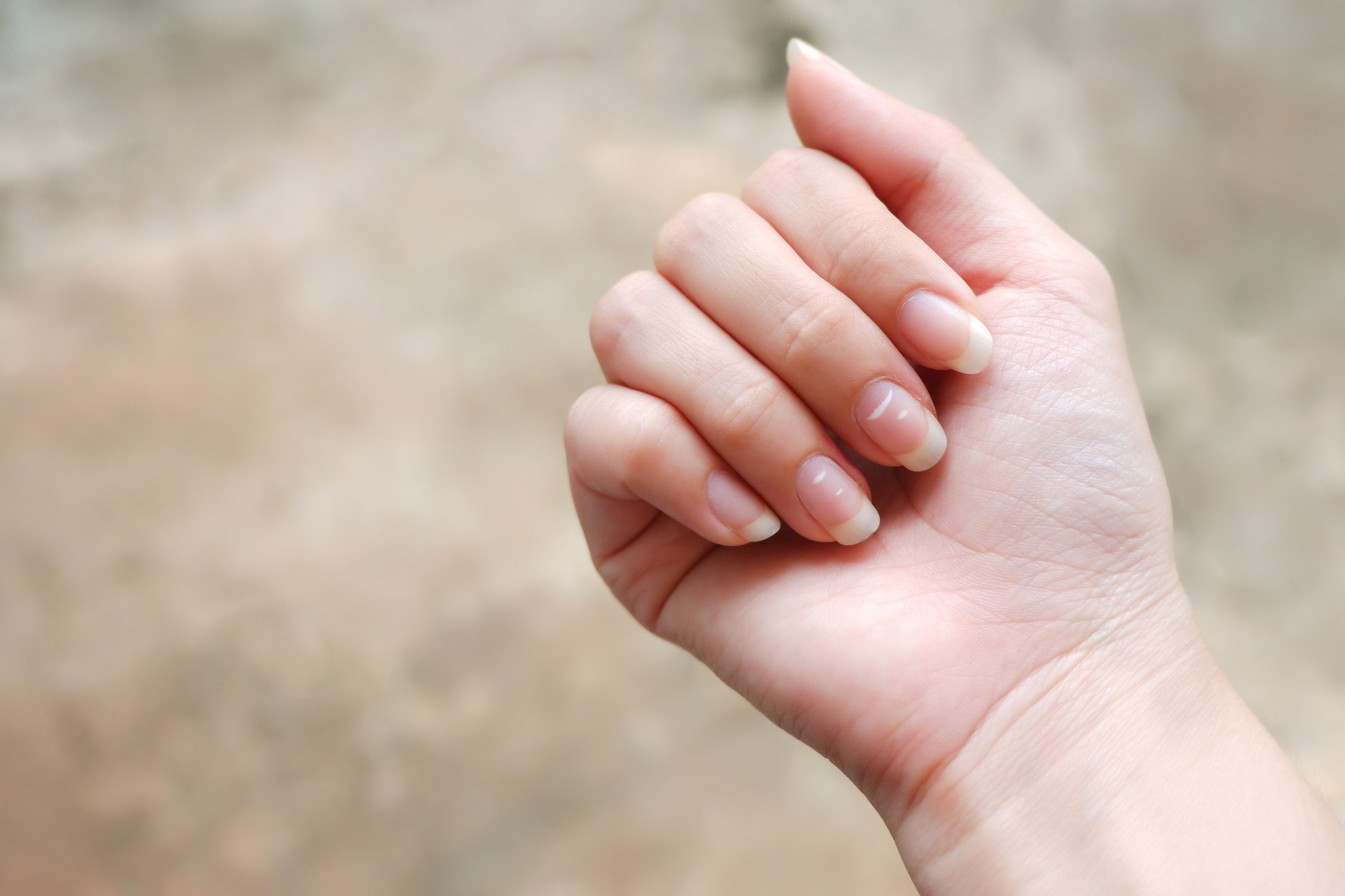 Manchas blancas en las uñas causas y cómo se trata